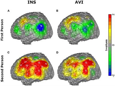 Monitoring Processes and Their Neuronal Correlates as the Basis of Auditory Verbal Hallucinations in a Non-clinical Sample